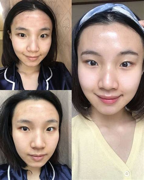 chanel facial korea|Chanel Injection: Koreans' Secret to Porcelain Skin .